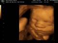 Baby Rowe 27 weeks  4D ultrasound
