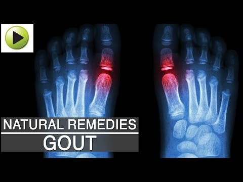 how to relieve plan b symptoms