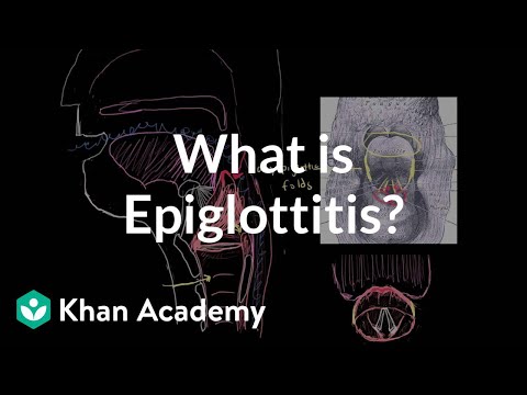 how to cure epiglottitis