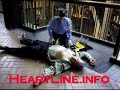 Automatic External Defibrillator AED Electrodes Heart Zoll Pads