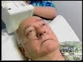 Hyperthermia Treatment of Skin Cancer Tumor