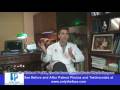 videos de Facial Plastic Surgery Has Less Downtime Than You Think