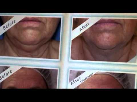 how to keep a youthful skin