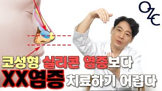 코성형 관련 영상