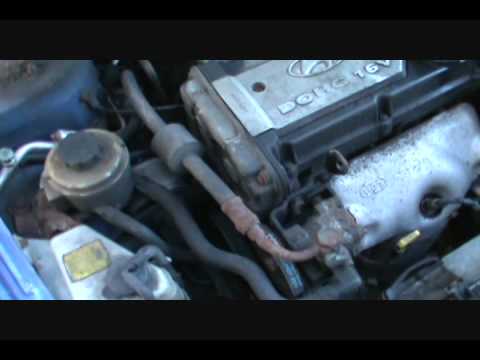 Part 1 Changing Your Timing Belt Accent 1.6L Eng.