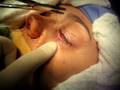 CIRURGIA MAXILO FACIAL Dr MARTINS Dr SARAIVA