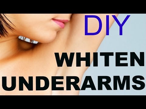 how to whiten armpits fast