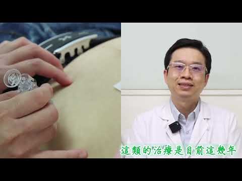 乾癬與乾癬性關節炎治療