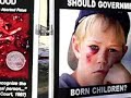 Pro-Life vs Pro-Choice Video - Sibbald, Scott.wmv Pro-Life vs Pro-Choice Video - Sibbald, Scott.wmv