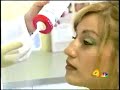 Rhinoplasty nose job without plastic surgery technique Rhinoplasty nose job without plastic surgery technique