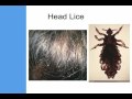 Infectious Agents Part 2