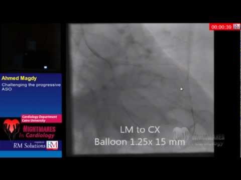 See video