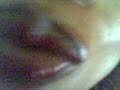 awilo