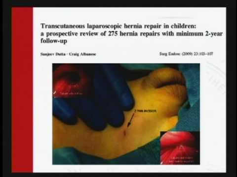 A Presentation on the Innovations in Minimal Access Paediatric Surgery