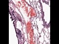 Shotgun Histology Lung