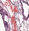 Shotgun Histology Lung