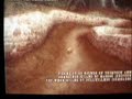 V�deo Medal OF Honor Heroes 2 multiplayer