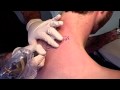 Tattoo Shine