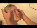 Wenkbrauwlift | drs. de Blecourt 