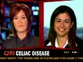 CELIAC DISEASE CNN 1