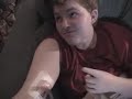 PICC line - not PIG line PICC line - not PIG line