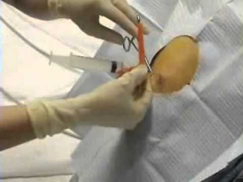 how to drain lungs of fluid