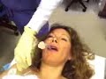 Intubation Intubation