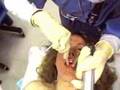 Intubation
