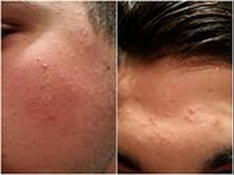 PELLE viso DA FAVOLA scrub profondo risolve\