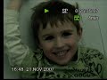My son Jonah aged 5 with a very clear shot of his dancing eyes.  (opsoclonus myolclonus)I shot this video over the top of the hospital tv and you can see when he spots I am there.    Background info:  Jonah suddenly stopped walking last October and then his arms went all wobbly and then his eyes went.  It took 6 weeks for the hospital in London to find the tumour.  He has had a resection (operation to remove the tumour) but unfortunately the tumour is growing again.  He has dexamethasone steroids IV through his port each month but other than that has had no other treatment.    As you can see from the video, he is still  a very happy little boy regardless of all the problems he has!!