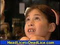 Head Lice to Dead Lice Head Lice to Dead Lice