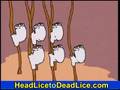 How to Kill Head Lice default How to Kill Head Lice