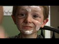 Fast Aging Child