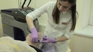 SMAS-лифтинг в клинике Gold laser