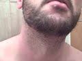 gross lip zit pop