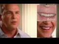 Dental Implants and Bride Repair | Cosmetic Dentist Pasadena