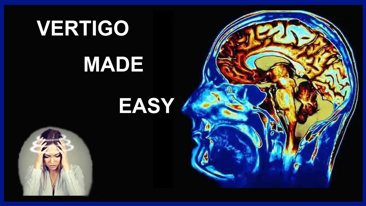 VERTIGO MADE EASY