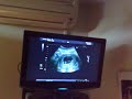 kleine larsie op tv