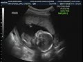 19 week Baby Boy Ultrasound