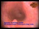 GASTROSCOPY