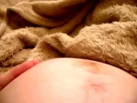 37weeks bump hiccups/Braxton Hicks contractions