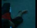 videos de fractura de carlitos parte 2