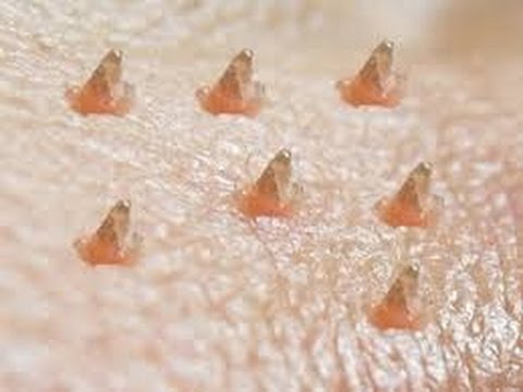 オロナイン 毛穴パック