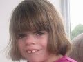 Cornelia de Lange Syndrome Awarenes Cornelia de Lange syndrome