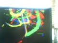 Wiimote Infrared Art Wiimote Infrared Art