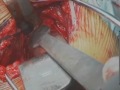 Movie 7 Bankart