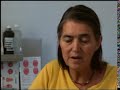 Diabetic MD Amputee Case Study