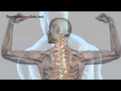 how to cure shoulder impingement