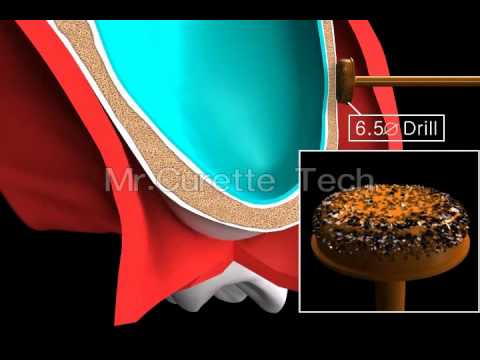 how to get rid of s'sinus infection