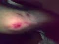 gica-hirsu-la-spital